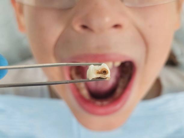 Best Holiday Emergency Dentist in Creston, OH